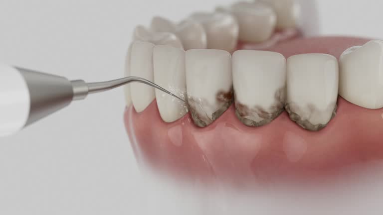 Trusted Teeth Cleaning And Checkup service in North Muskegon, MI - Dentist Open Now